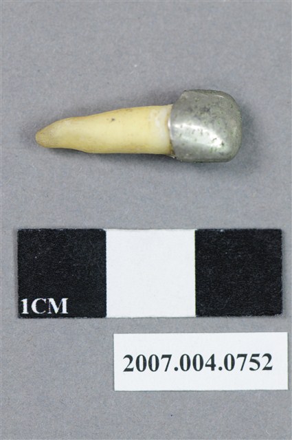 牙科門牙齒模 (共4張)