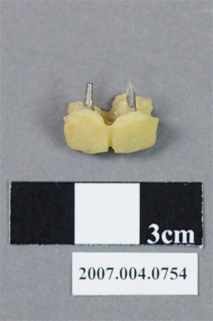 牙科門牙齒模 (共4張)