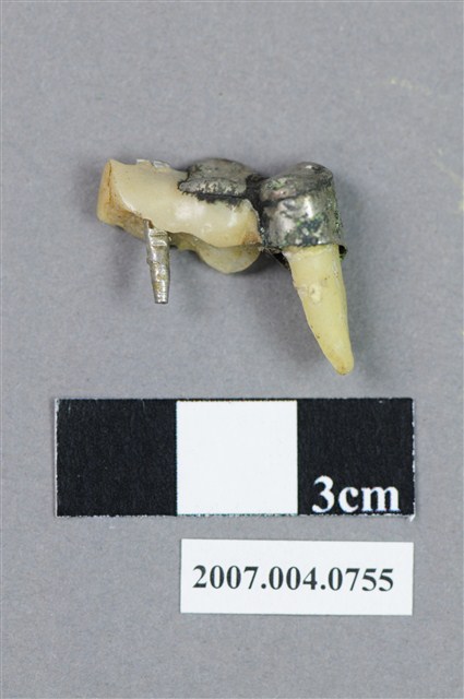 牙科前臼齒齒模 (共6張)