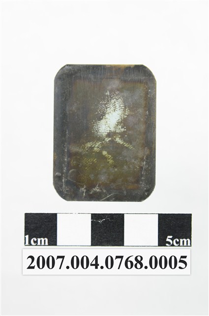 牙科X光片 (共2張)