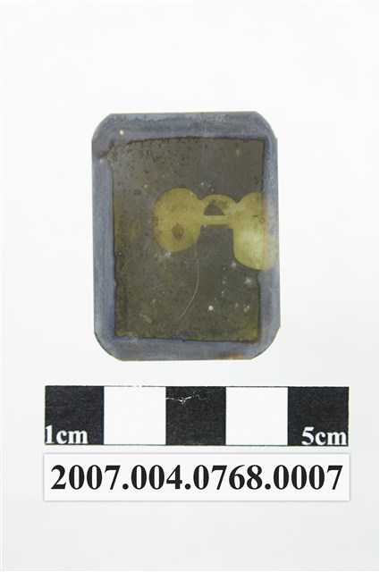 牙科X光片 (共2張)