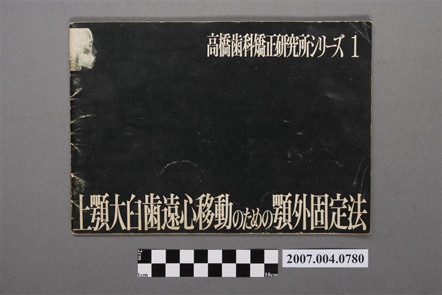 高橋齒科矯正研究所著《上顎大臼齒遠心移動のための顎外固定法》 (共4張)