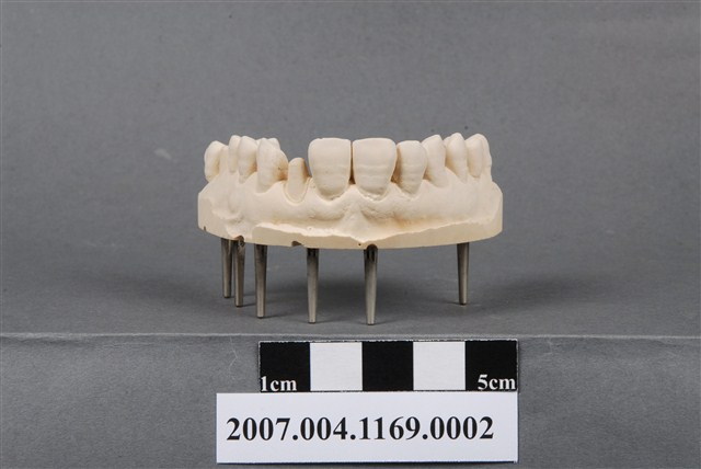 合金牙冠和瓷牙冠製作分解模型2 (共7張)