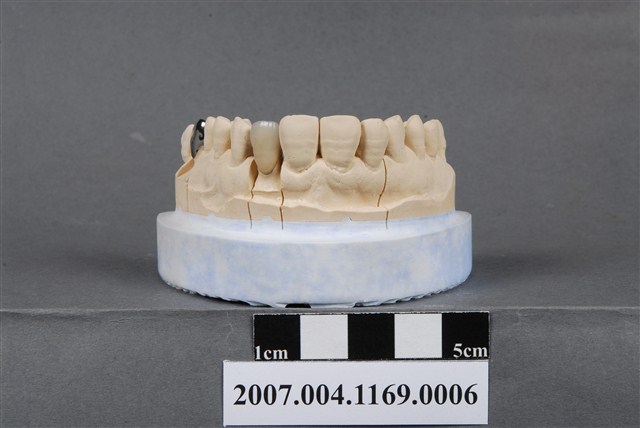 合金牙冠和瓷牙冠製作分解模型6 (共7張)