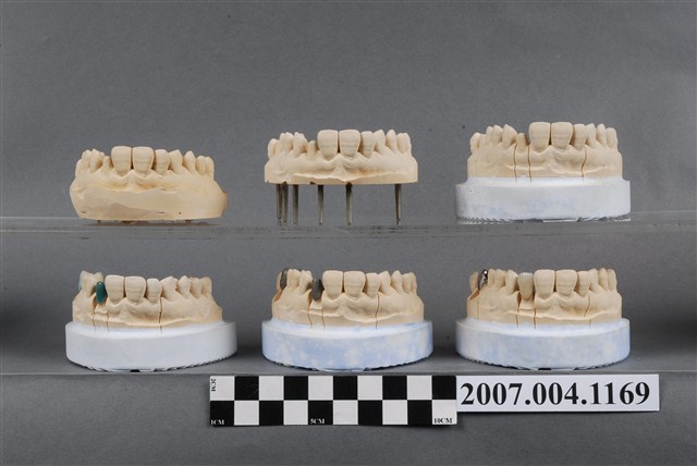 合金牙冠和瓷牙冠製作分解模型 (共7張)
