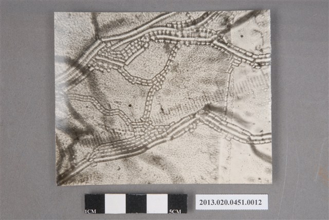 「Monilia念珠胞子」顯微照片 (共4張)