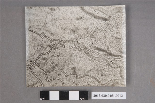 「Monilia念珠胞子先端」顯微照片 (共4張)