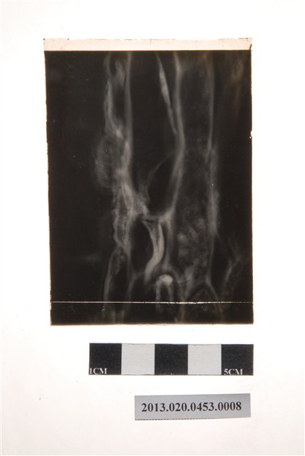 52小時後之分生孢子盤顯微玻璃底片 (共4張)