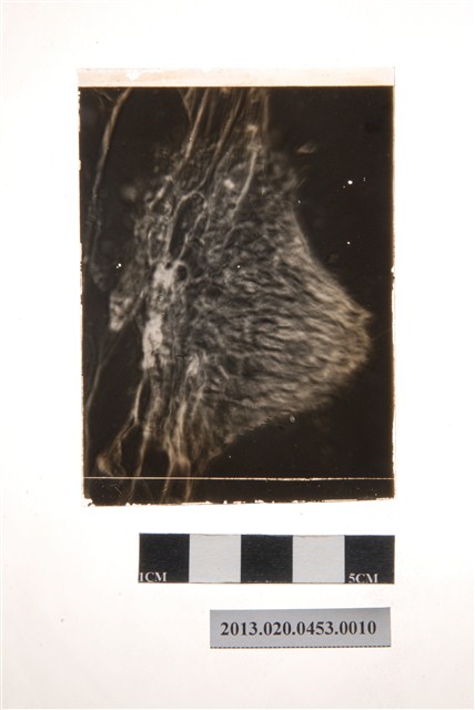 149小時後之分生孢子盤顯微玻璃底片 (共4張)