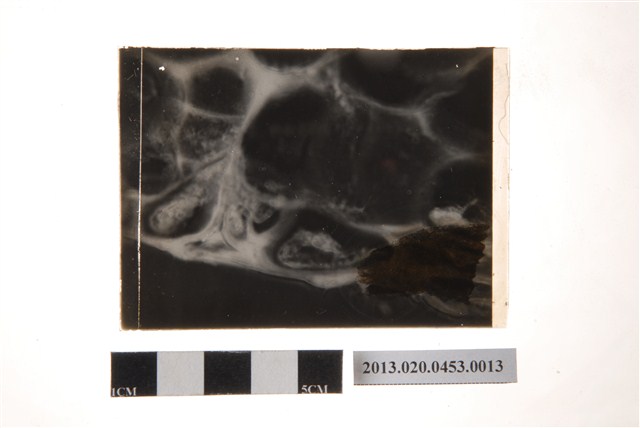 168小時後之分生孢子盤顯微玻璃底片 (共4張)