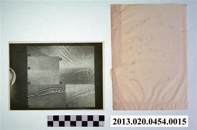 民國62年5月14日賴炳琳真菌顯微底片 (共2張)