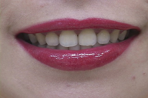 藏品:紅唇的(3)張圖片