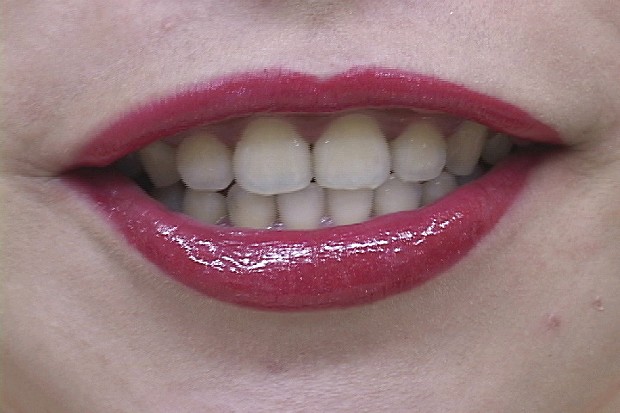 藏品:紅唇的(4)張圖片