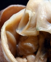 雙乳突僧頭烏賊藏品圖，第5張