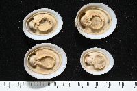 尖頂梳齒笠螺藏品圖，第14張