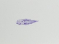 新種棘槽絛蟲藏品圖，第3張