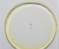 新種棘槽絛蟲藏品圖，第7張
