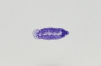 新種棘槽絛蟲藏品圖，第4張