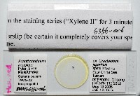 新種棘槽絛蟲藏品圖，第5張