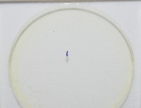 新種棘槽絛蟲藏品圖，第7張