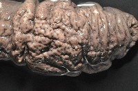 黑囊皮參藏品圖，第2張
