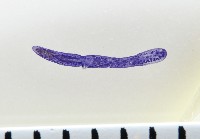 新種葉槽絛蟲藏品圖，第1張