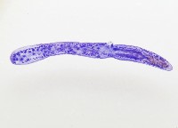 新種葉槽絛蟲藏品圖，第4張