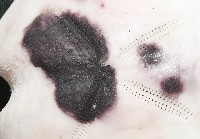 心形緣帶海膽藏品圖，第2張