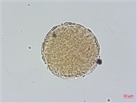 蒲瓜樹、炮彈果藏品圖，第2張