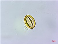 杏葉石櫟、校栗、校櫟藏品圖，第2張