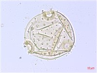 翅子樹、裡白翅子樹、臺灣翅子樹藏品圖，第1張