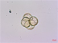 砲彈樹藏品圖，第3張