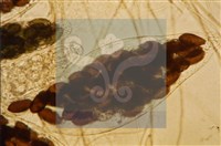 Accession Number:F0012865 Collection Image, Figure 5, Total 5 Figures