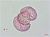 蘭嶼羅漢松藏品圖，第2張