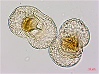 蘭嶼羅漢松藏品圖，第3張