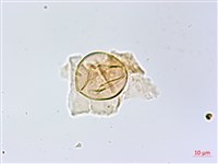 長柄牙蕨藏品圖，第4張