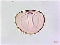 叢葉鐵角蕨藏品圖，第3張