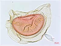 隱脈細柄雙蓋蕨藏品圖，第4張