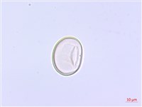 過溝菜蕨藏品圖，第3張