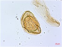 亞德氏蹄蓋蕨、假冷蕨藏品圖，第2張