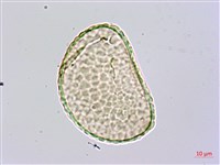 杯狀蓋陰石蕨藏品圖，第2張