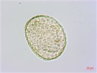 杯狀蓋陰石蕨藏品圖，第3張