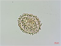 細葉姬蕨藏品圖，第2張