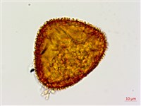 台灣黑桫欏藏品圖，第2張