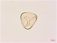 黑桫蕨藏品圖，第2張