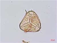 黑桫蕨藏品圖，第3張