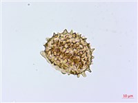 假蹄蓋蕨、東洋蹄蓋蕨藏品圖，第4張