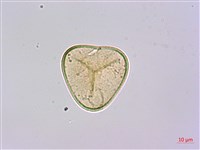 刺柄碗蕨藏品圖，第3張