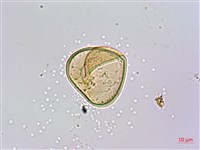 刺柄碗蕨藏品圖，第4張