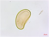 裂葉鐵角蕨藏品圖，第3張